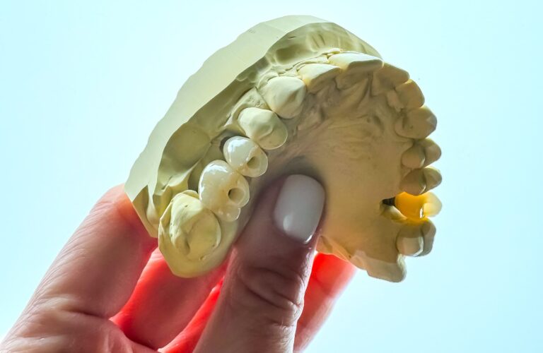 Korony na implantach