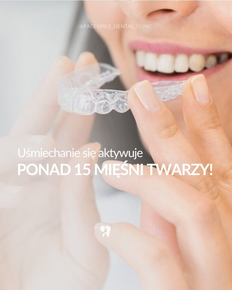 Uśmiech, invisaligne