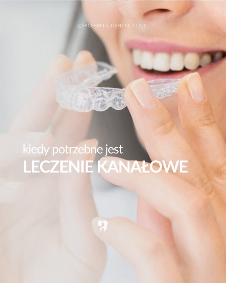 Leczenie kanałowe